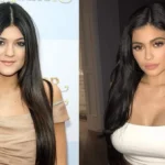 Kylie Jenner Discusses Plastic Surgery