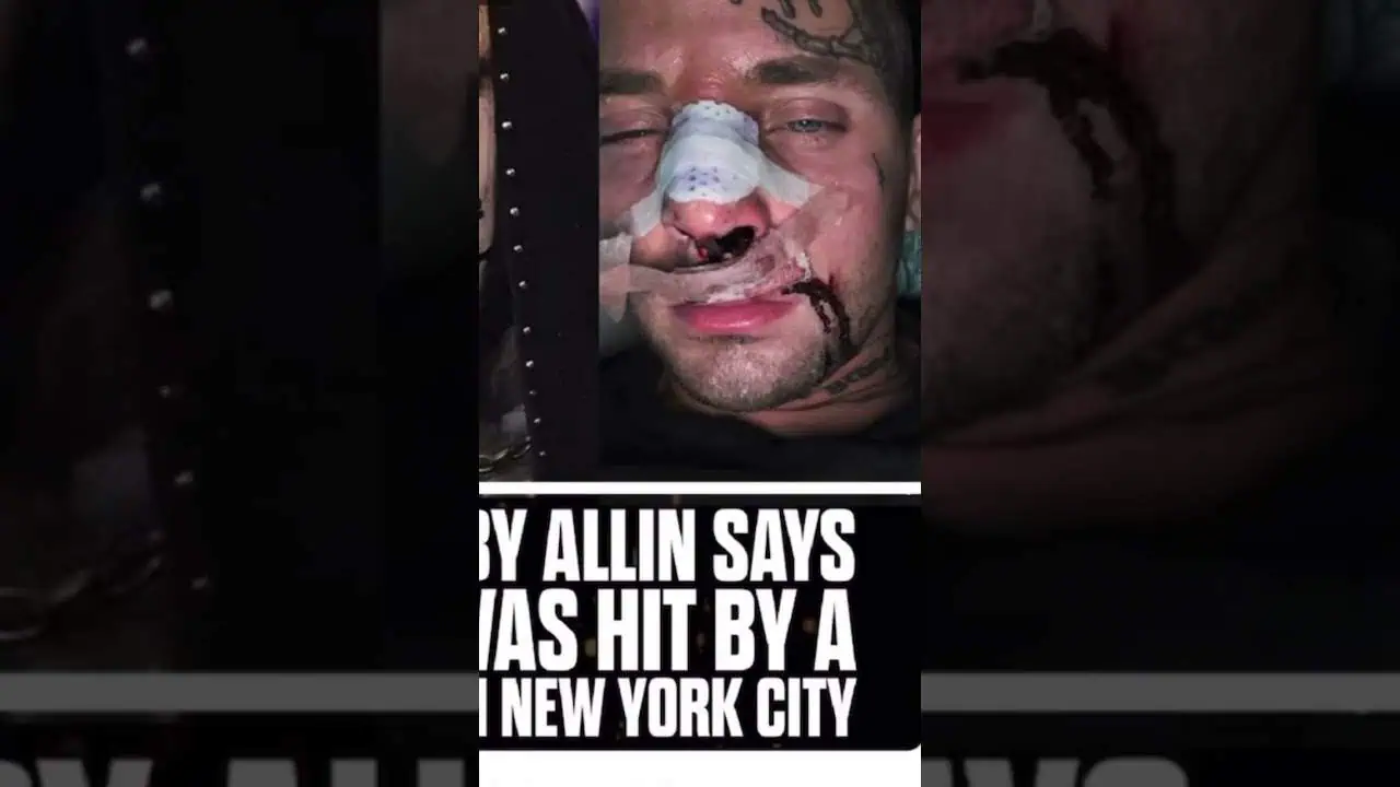 Darby Allin Accident video